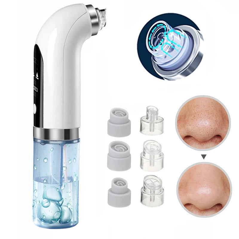 PoreClean™ Blackhead Remover Vacuum