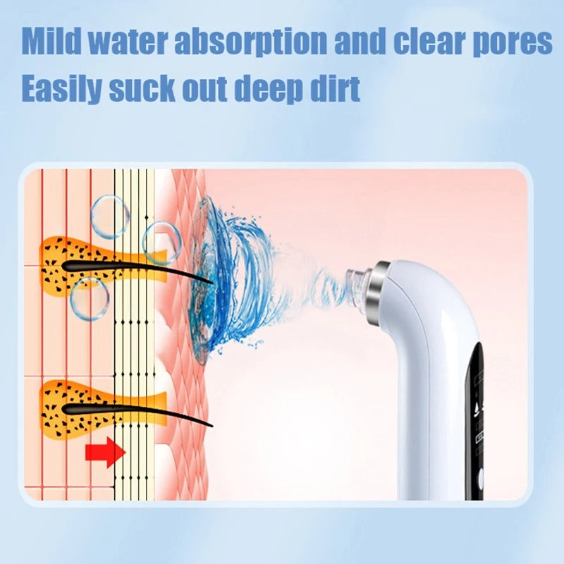 PoreClean™ Blackhead Remover Vacuum