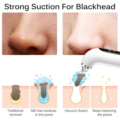 PoreClean™ Blackhead Remover Vacuum