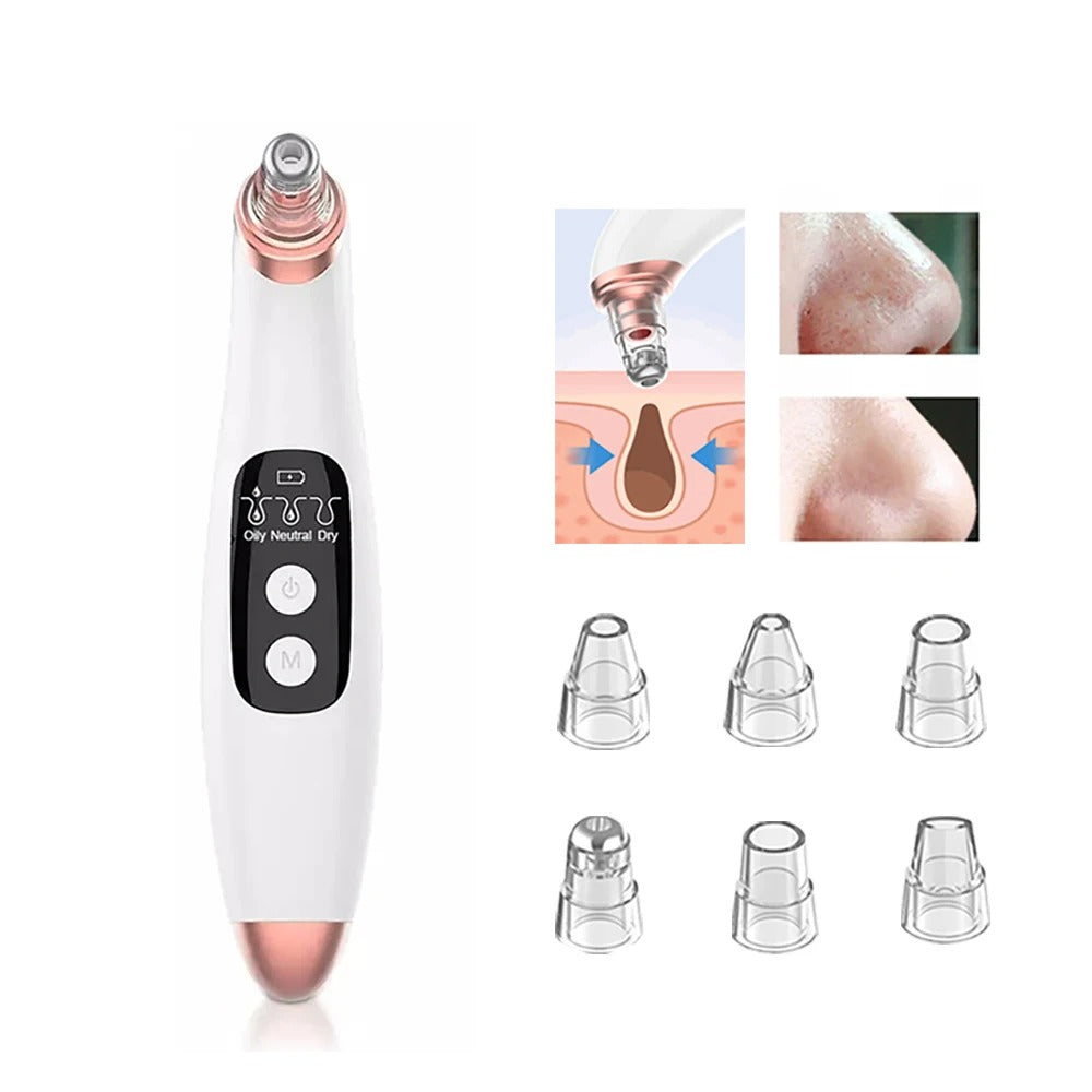 PoreClean™ Blackhead Remover Vacuum