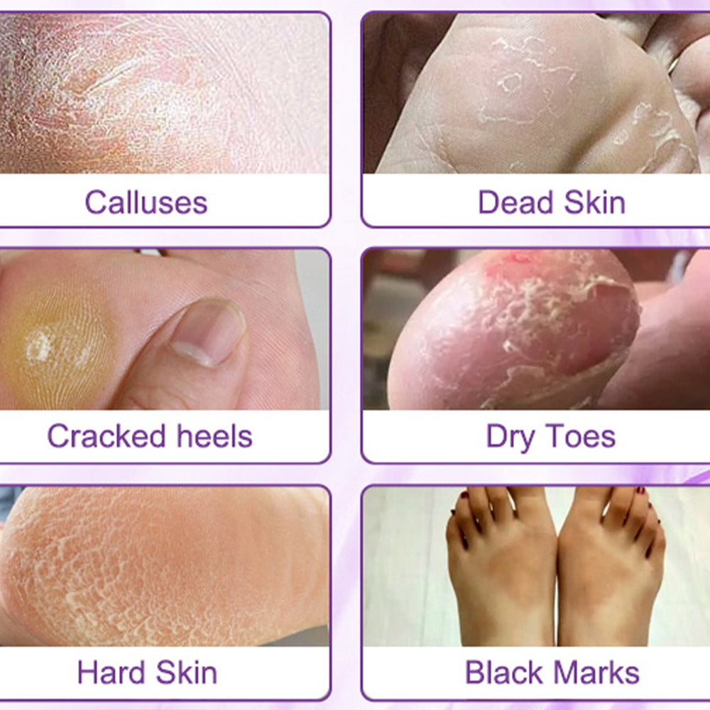 SilkyFeet™ Exfoliating Foot Peel