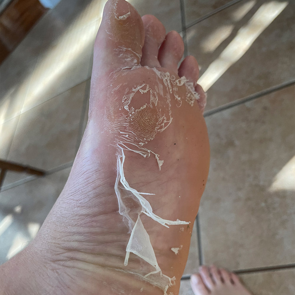 SilkyFeet™ Exfoliating Foot Peel